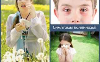 Симптомы, профилактика и лечение поллиноза
