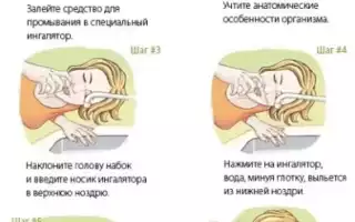 Как промывать нос солевым раствором в домашних условиях