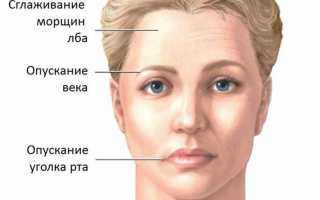 Простуда от кондиционера