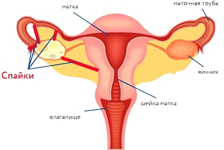 Патологии месячных после кесарева