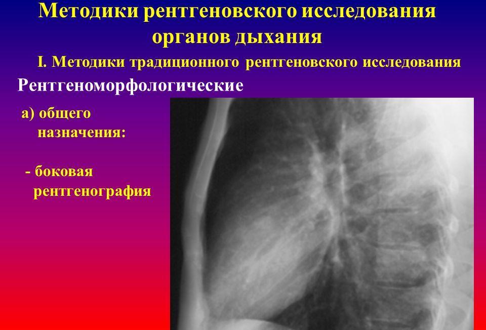 Рентгенографическое исследование