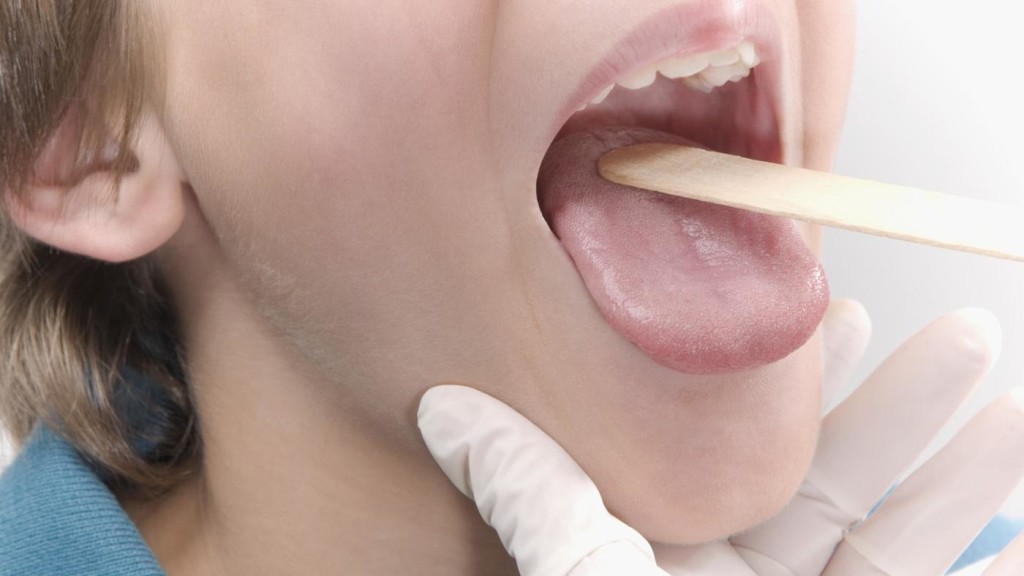 Белый налет на языке у взрослых: причины физиологические